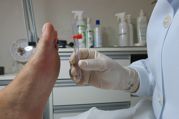 podologo a domicilio madrid